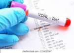 VDRL