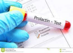 PROLACTINA