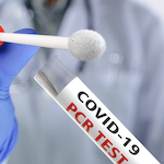 SARS-CoV2 PCR NASOFARINGEO