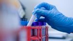 PANEL SEXUAL COMPLETO C/CANDIDA (MOLECULAR)