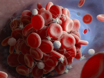 ANTICOAGULANTE LUPICO